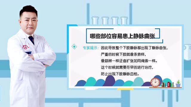 最新血栓治疗突破传统，重塑健康之路新篇章