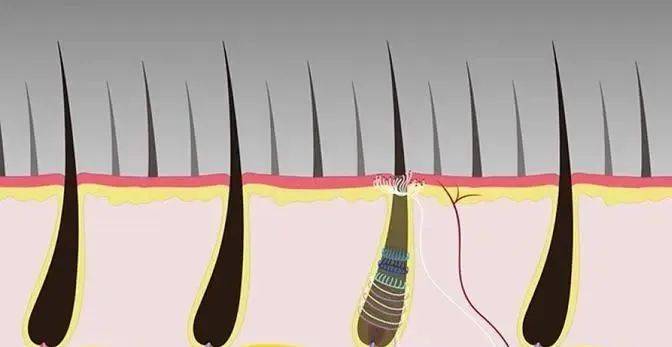 毛囊克隆技术重塑美丽与未来，最新科技引领毛发再生新篇章